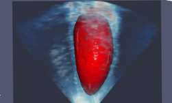 NVIDIA Clara SDK ���ѿ���