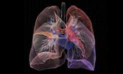 NVIDIA �����Ƴ�������ҽѧӰ���Ǩ��ѧϰ���߰��� AI ����ע�� SDK