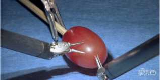 ������ҽ��ʱ���������ͼ�ҽ�����ı仼�߽��ܶ�